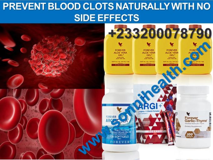 HOW TO PREVENT BLOOD CLOTS NATURALLY WITH NO SIDE EFFECTS Sonni Health