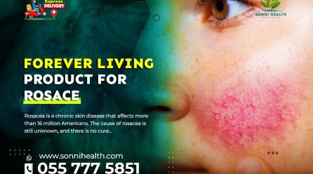 FOREVER LIVING PRODUCT FOR ROSACEA