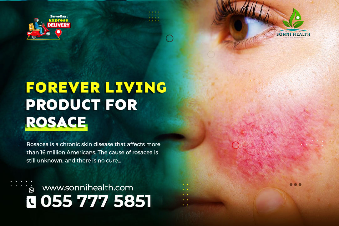 FOREVER LIVING PRODUCT FOR ROSACEA