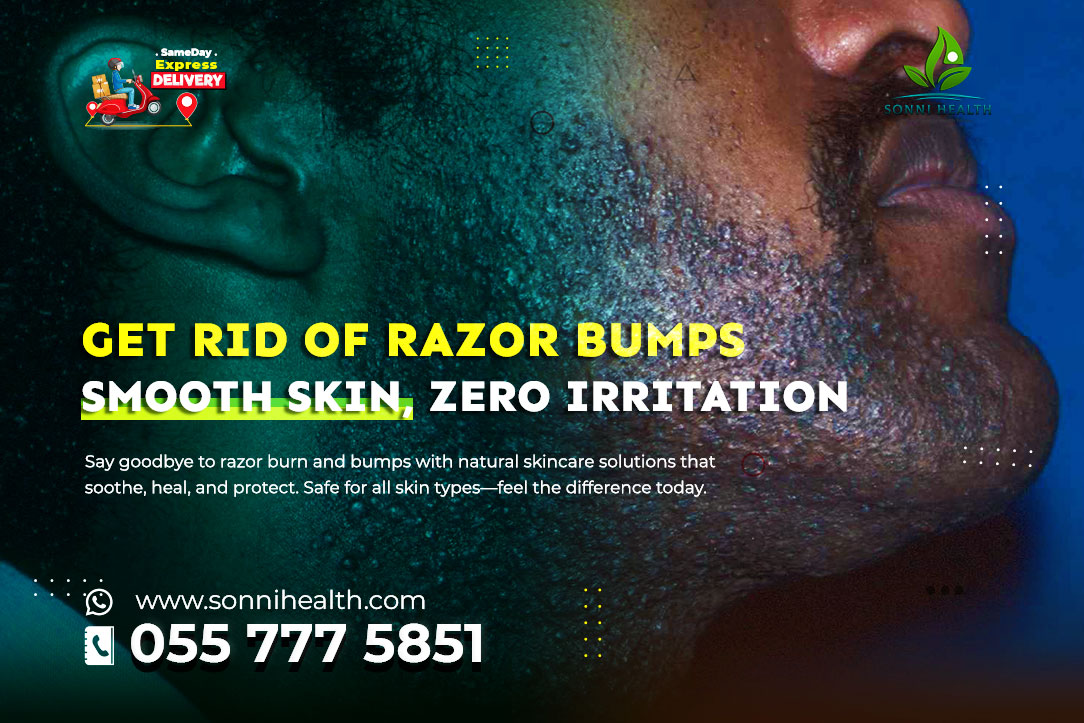 GET RID OF RAZOR BUMPS