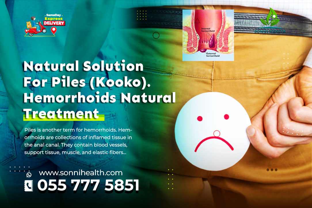 NATURAL SOLUTION FOR HEMORRHOIDS (PILES) – PERMANENT TREATMENT FOR BOTH INTERNAL & EXTERNAL HEMORRHOIDS(PILES)