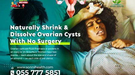 NATURALLY SHRINK & DISSOLVE OVARIAN CYSTS WITH NO SURGERY