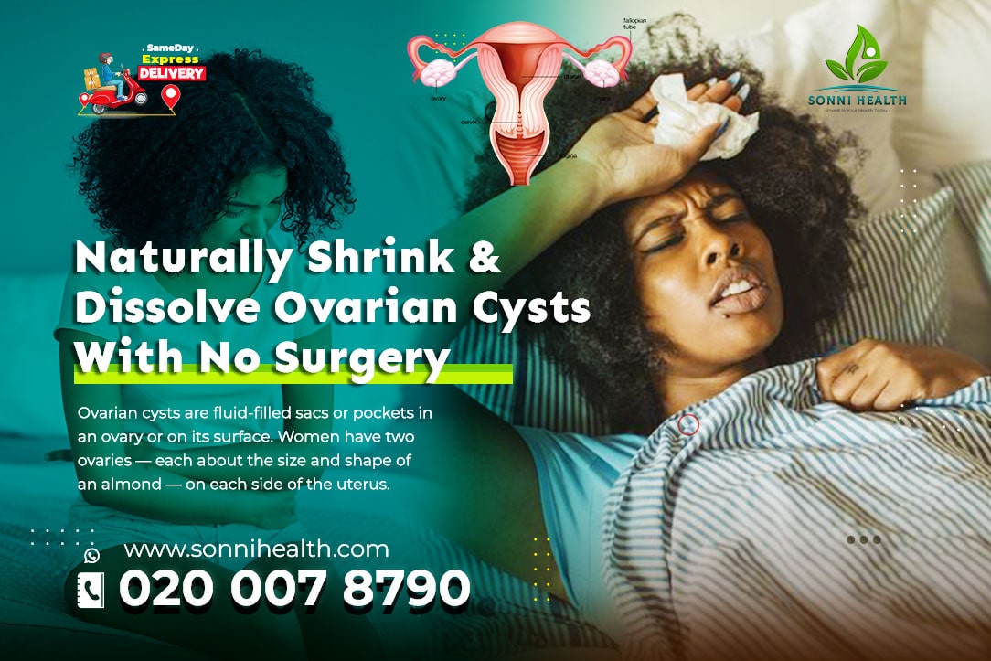 NATURALLY SHRINK & DISSOLVE OVARIAN CYSTS WITH NO SURGERY