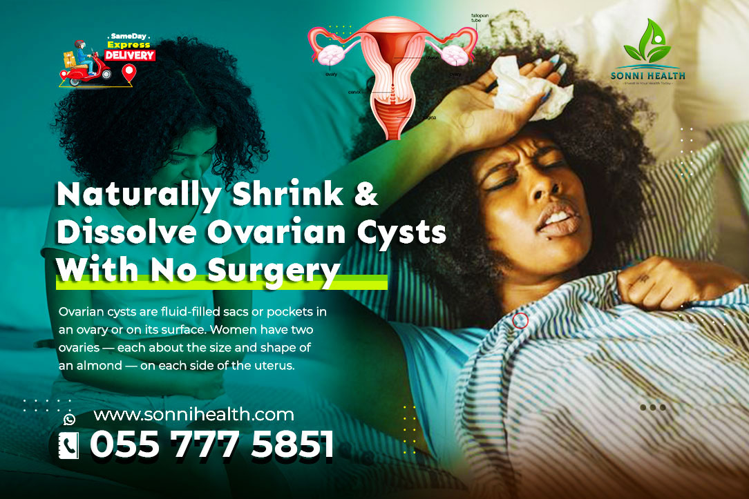 NATURALLY SHRINK & DISSOLVE OVARIAN CYSTS WITH NO SURGERY
