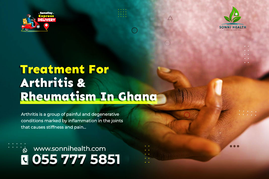 TREATMENT FOR ARTHRITIS & RHEUMATISM IN GHANA