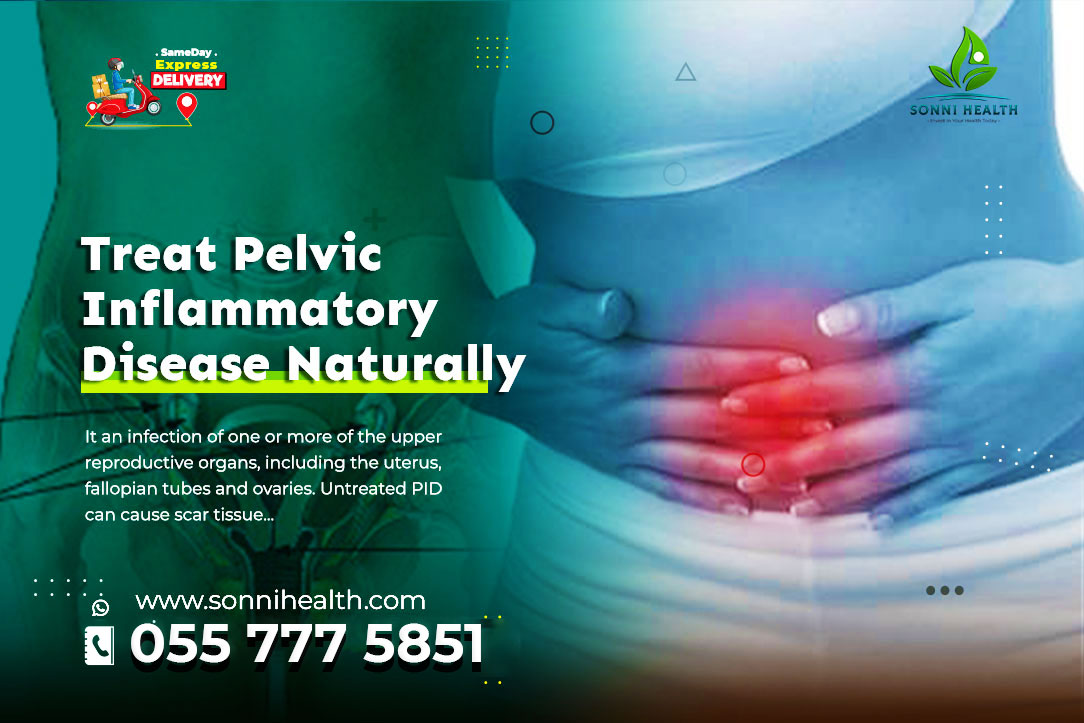 TREAT PELVIC INFLAMMATORY DISEASE NATURALLY WITH NO SIDE EFFECT